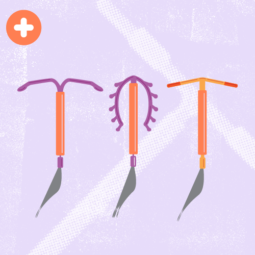 Intrauterine Contraceptive Devices (IUDs)